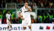 Juventus' Gonzalo Higuain wipes his face. REUTERS/Alessandro Garofalo