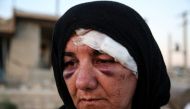 A wounded woman is seen at debris of a building in Kalaleh town of Kermanshah, Iran on November 14, 2017 following a 7.3 magnitude earthquake that hit the Iraq and Iran. (Fatemeh Bahrami - Anadolu Agency)