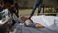 Pakistani paramedics push a stretcher carrying an injured Chinese national to an hospital after an attack by gunmen in Karachi on February 5, 2018. / AFP / ASIF HASSAN
