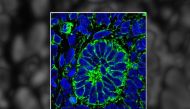 Kidney glomeruli -- constituent microscopic parts of the organ- were generated from human embryonic stem cells grown in plastic laboratory culture dishes. Credit: Image courtesy of University of Manchester