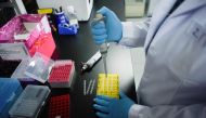 This picture taken on May 14, 2020 shows a researcher at Peking University's Beijing Advanced Innovation Center for Genomics conducting tests at their laboratory in Beijing. The Chinese laboratory says it has developed a drug it believes has the power to 