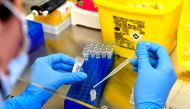 A lab assistant manipulates samples, at a COVID-19 screening centre of Saint Andre Hospital in Bordeaux, on May 20, 2020. AFP / GEORGES GOBET
