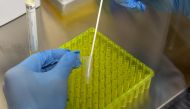 In this file photo taken on July 10, 2020, A lab assistant preparating for testing corona samples from passengers at the corona screening station in the medical center of the Franz-Josef-Strauss airport in Munich, southern Germany, amid the novel coronavi