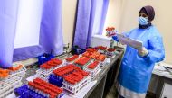 A technician handles collected PCR (polymerase chain reaction) swab samples collected as part of COVID-19 coronavirus disease testing, at the Palestinian Gaza-based Health Ministry central laboratory in Gaza City on December 7, 2020. / AFP / MAHMUD HAMS