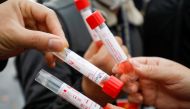 Journalists hold their sample tubes at the National Convention Center, the venue for the 13th National Congress of the Communist Party of Vietnam, during the coronavirus disease (COVID-19) outbreak in Hanoi, Vietnam January 29, 2021. REUTERS/Kham/File Pho