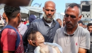 The father of Yahya Fadi al-Najjar, an infant who died due to malnourishment, holds his body during the funeral at Nasser Medical Complex in Khan Yunis in the southern Gaza Strip on July 20, 2025. (Photo by AFP)