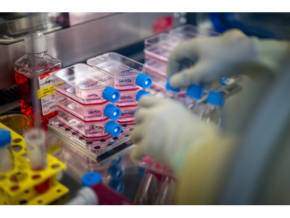 A biomedical analysts works at the cell production centre of the Lausanne University Hospital (CHUV) in Epalinges above Lausanne, on January 13, 2026. Photo by Fabrice COFFRINI / AFP