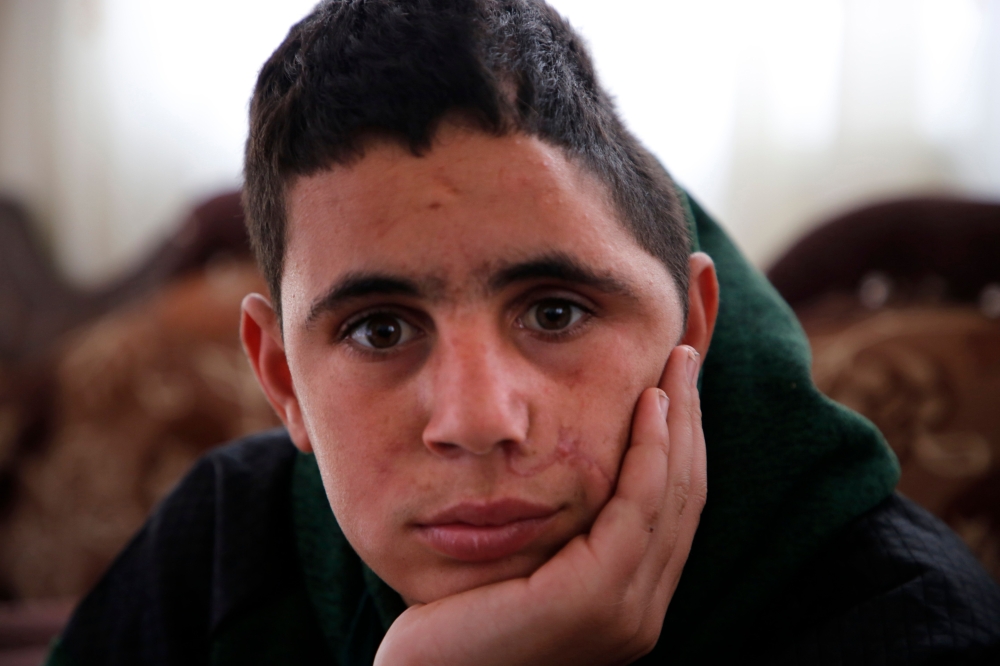 Palestinian Mohammed al-Tamimi, 15, poses for a picture at his family home in the West Bank city of Ramallah on February 27, 2018.  AFP / Abbas Momani