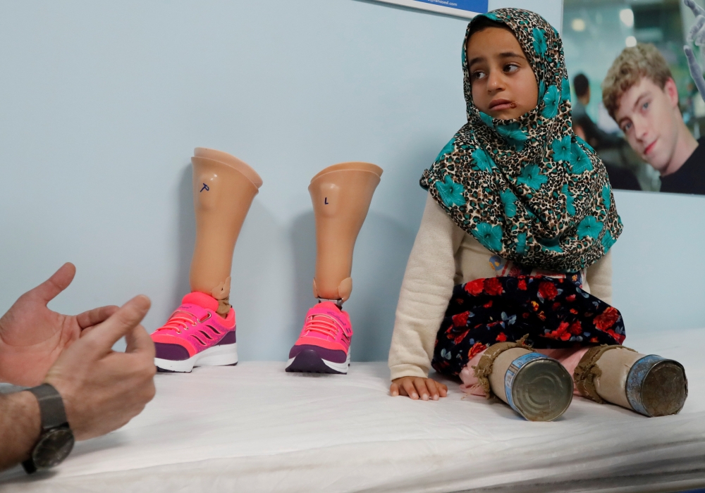 Maya Meri, 8, waits at a prosthetic center in Istanbul, Turkey, July 5, 2018. Picture taken July 5, 2018. REUTERS/Osman Orsal 