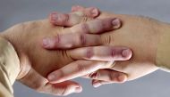 Love it or loathe it, knuckle-cracking is very common. Earlier studies have established that not all joints can be cracked, and that -- for that those that can -- the act can't be repeated for another 20 minutes.
Knuckle-cracking is a common habit (Pictu