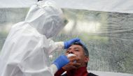 Health staffers of the city government carry out Covid-19 testing at a park in the Doctores neighborhood in Mexico City on August 11, 2020. / AFP / ALFREDO ESTRELLA
