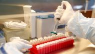 FILE PHOTO: A scientist filters out samples during the research and development of a vaccine against the coronavirus disease (COVID-19) at a laboratory of BIOCAD biotechnology company in St Petersburg, Russia June 11, 2020. REUTERS/Anton Vaganov/File Phot