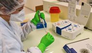A researcher from the Sys2Diag laboratory, from the biotechnology company SkillCell, holds a saliva sample to perform a rapid screening for Covid-19, in Montpellier, southern France, on October 13, 2020. / AFP / Pascal GUYOT
