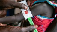 Regina Williams is screened for malnutrition at the Nyong Primary Health Care Unit (PHCU) nutrition site in Torit in this photo released November 3, 2022. World Food Programme/Handout via Reuters