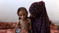 Nine-year-old malnourished Palestinian girl Mariam Dawwas sits on the floor with her mother in the Rimal neighbourhood in Gaza City on August 2, 2025. (Photo by Omar AL-QATTAA / AFP)
