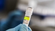 nstitute holding a container used to diagnose the Andes hantavirus, which contains RNA from the Andes virus as part of the detection process, in Buenos Aires on May 6, 2026. Argentina has seen an increase in hantavirus cases but not an outbreak, an expert told AFP on May 6, as infections aboard a cruise ship have provoked a global health scare. The MV Hondius set sail from Ushuaia in southern Argentina on April 1 and is currently anchored off the coast of Cape Verde after three passengers died, possibly of hantavirus. (Photo by Handout / ARGENTINE HEALTH MINISTRY / AFP) 