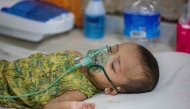 A child diagnosed with measles receives treatment inside a paediatric ward at the Bangladesh Shishu Hospital and Institute in Dhaka on May 6, 2026. (Photo by Salahuddin Ahmed / AFP)
