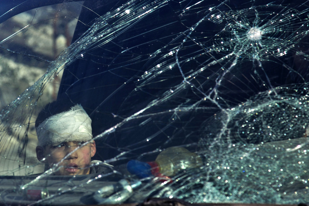 A wounded boy sits inside an ambulance as Syrian rebels and their families gather at the rebel-held al-Amiriyah neighbourhood as they wait to be evacuated to the government-controlled area of Ramoussa on the southern outskirts of the city on December 15, 