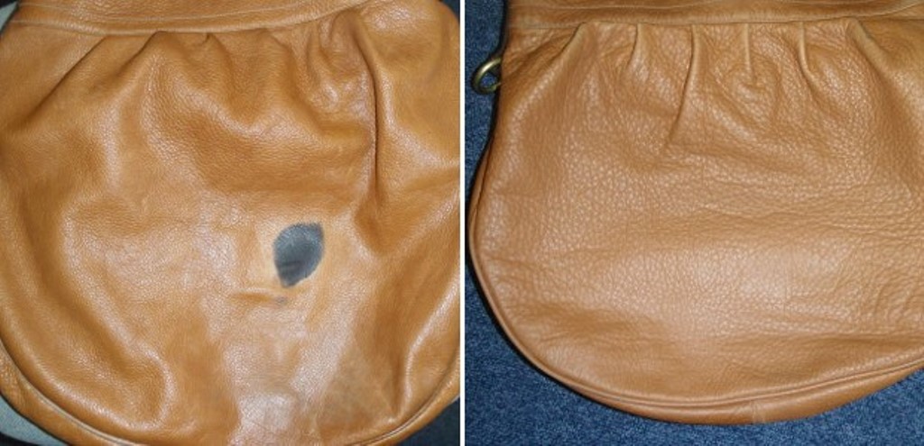 The clinic cleaned the bag and matched the colour to the rest of the leather, then added colour to the area that was stained.