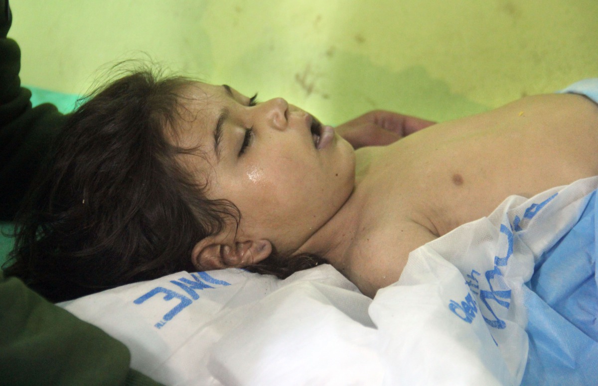 An unconscious Syrian child receives treatment at a hospital in Khan Sheikhun, a rebel-held town in the northwestern Syrian Idlib province, following a suspected toxic gas attack on April 4, 2017. AFP / Omar haj kadour