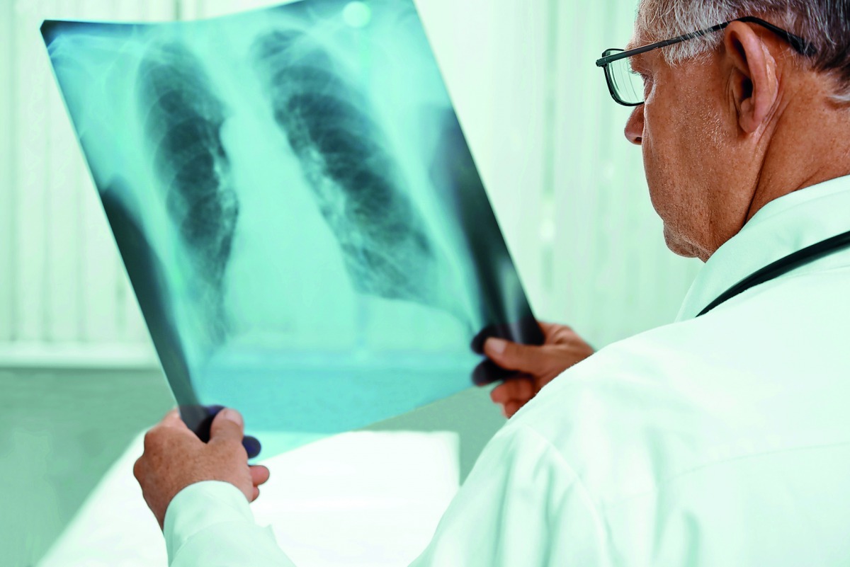 A health care practitioner examines a chest x-ray for diagnosing pneumonia.