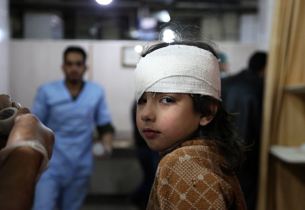 A wounded Syrian girl receives treatment at a make-shift hospital in Kafr Batna following Syrian government bombardments on the besieged Eastern Ghouta region on the outskirts of the capital Damascus on February 21, 2018.  AFP / Ammar SULEIMAN
