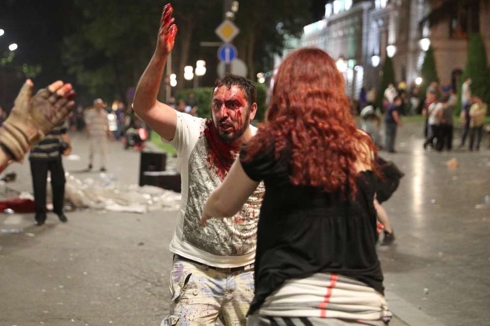 A man with blood on his face reacts after he was injured during a rally against a Russian lawmaker's visit in Tbilisi, Georgia June 21, 2019. Reuters/Irakli Gedenidze