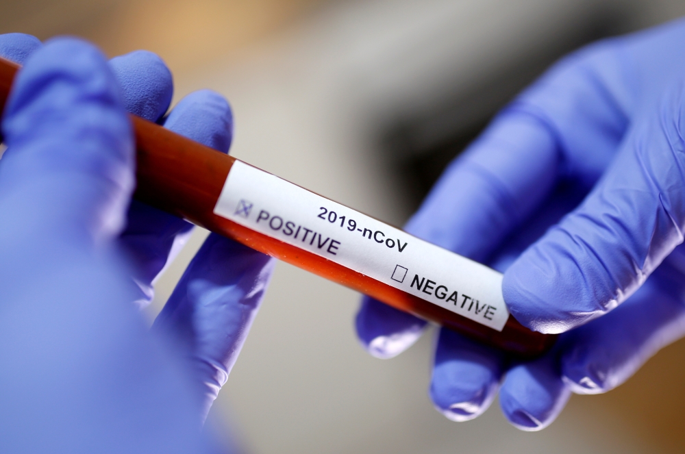 Test tube with Corona virus name label is seen in this illustration taken on January 29, 2020. Reuters/Dado Ruvic