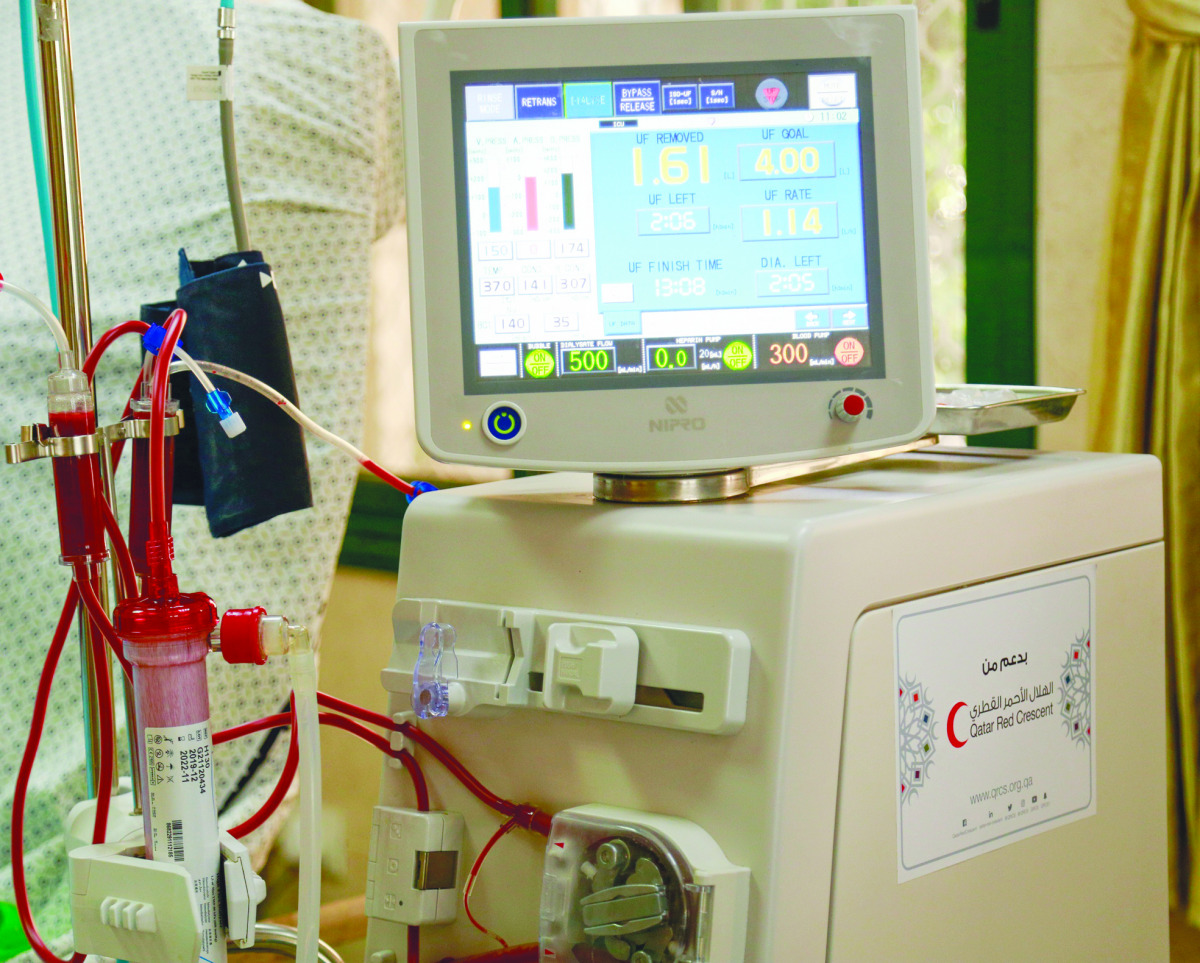 A dialysis machine.