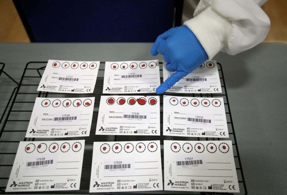 Blood samples are pictured during a clinical trial of tests for the coronavirus disease (COVID-19) antibodies, at Keele University, in Keele, Britain June 30, 2020. REUTERS/Carl Recine

Blood samples are pictured during a clinical trial of tests for the