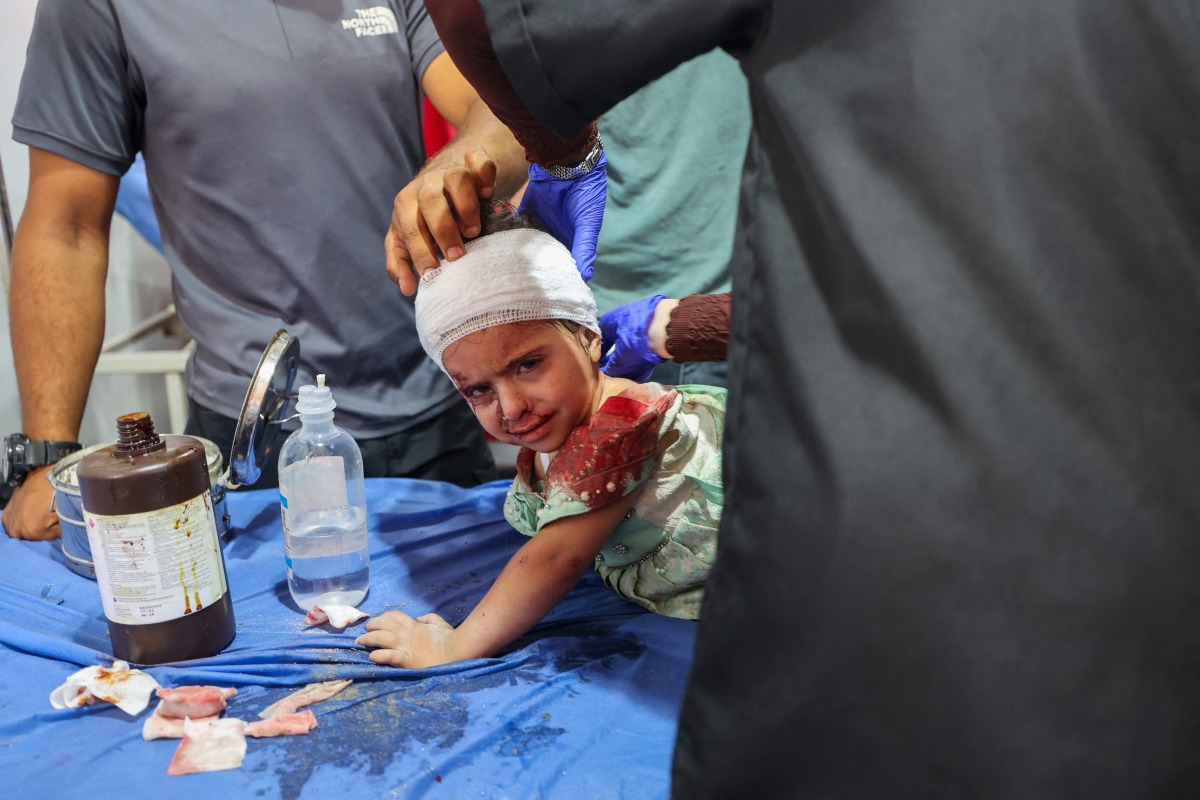 Palestinian casualties of an Israeli strike on an apartment at the Nuseirat refugee camp, receive care at Al-Awda hospital in the central Gaza Strip on July 19, 2025. (Photo by Eyad BABA / AFP)
